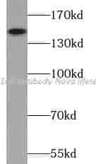 AS160 antibody