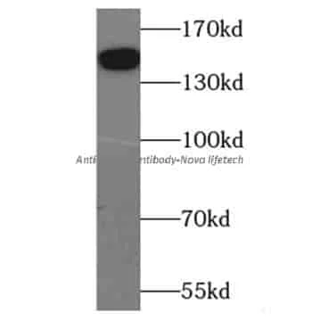 anti- THBS2 antibody