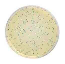 Escherichia Coli Bl21 De3 : Genomic and transcriptomic landscape of ...