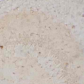 CBPE antibody