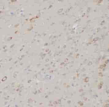 PSPB antibody