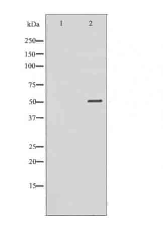 SRPX Antibody