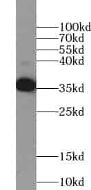 Anti-AASDHPPT antibody