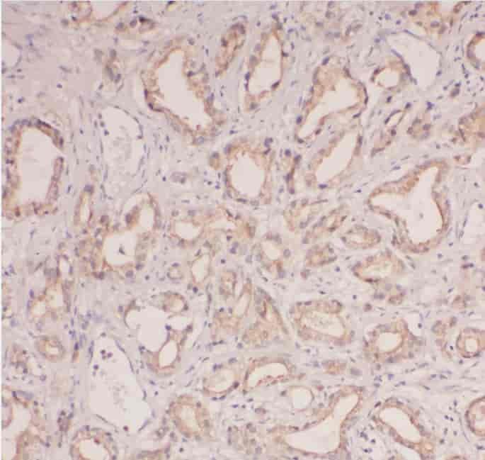 Anti-ABHD14B antibody