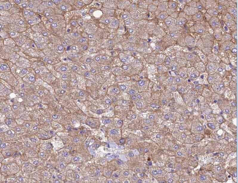 Anti-ABLIM1 antibody