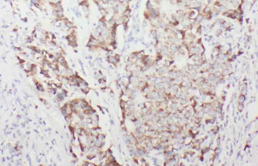 Anti-ACADSB antibody