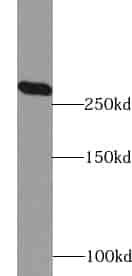 Anti-ACC1 antibody