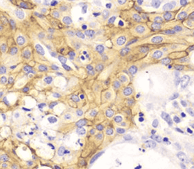 Anti-ACTA2/smooth muscle actin antibody
