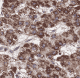 Anti-AFP antibody