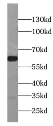 Anti-CCKBR-specific antibody