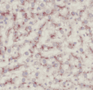 Anti-CD14 antibody