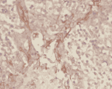 Anti-CD34 antibody