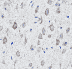 Anti-CHAT antibody