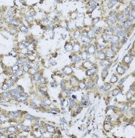 Anti-COX6A1 antibody