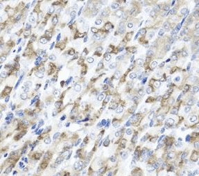 Anti-CST1 antibody