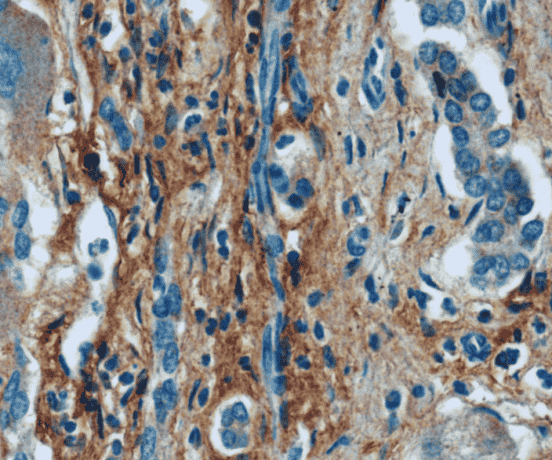 Anti-Collagen Type III antibody
