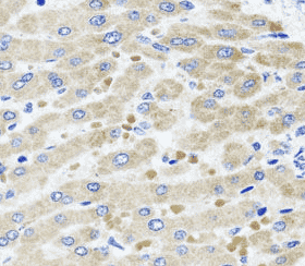 Anti-DARS2 antibody