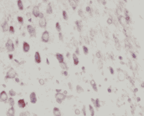 Anti-DAT antibody