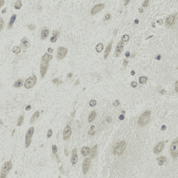 Anti-DHRS9 antibody
