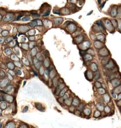 Anti-FOXRED1 antibody