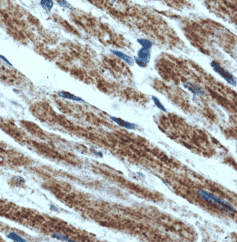 Anti-HCN2 antibody