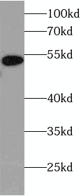 Anti-HPSE antibody Anti-HPSE antibody