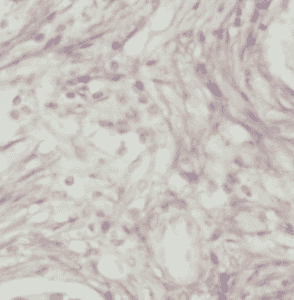 Anti-IGFBP3 antibody