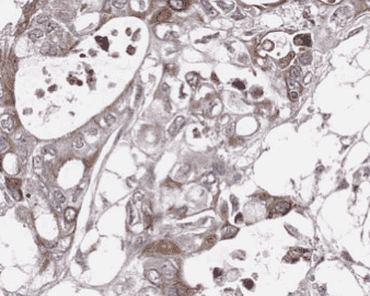 Anti-IL-10 antibody