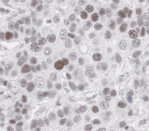 Anti-IRAK1 antibody