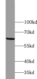 Anti-Integrin alpha 6X1B-Specific antibody