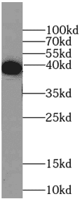 Anti-MBP-Tag antibody