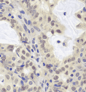 Anti-MCM3 antibody