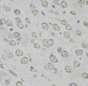 Anti-MYO10 antibody