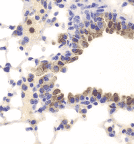 Anti-NFKB1 antibody