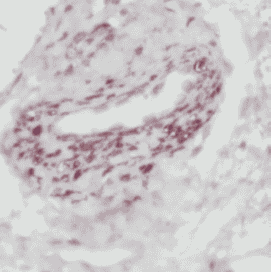 Anti-NLRP1 antibody