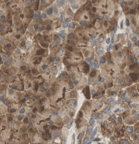 Anti-NQO1 antibody