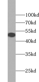 Anti-NR1H3 antibody