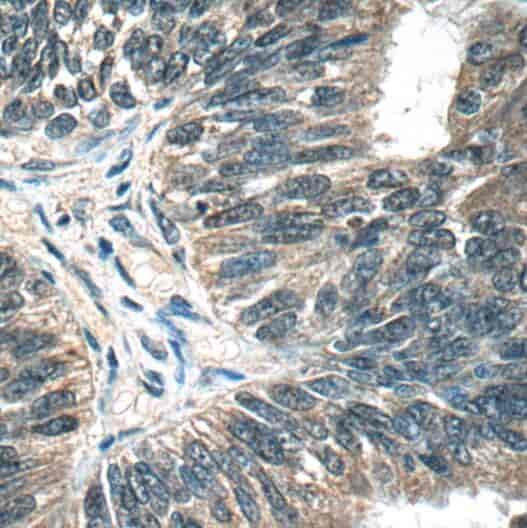 Anti-OTUD6B antibody