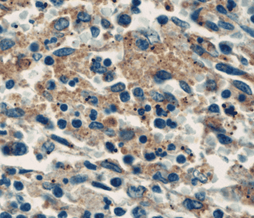 Anti-P-selectin antibody - Click Image to Close