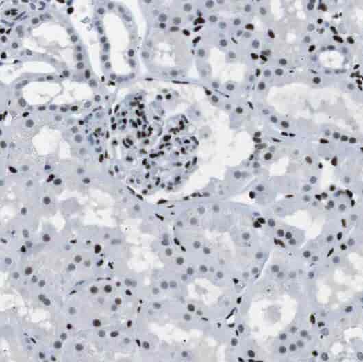 Anti-PDE2A antibody