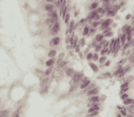 Anti-PER3 antibody