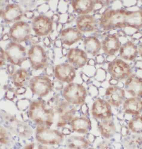 Anti-PFTK1 antibody