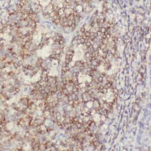 Anti-PGP antibody