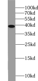 Anti-PHC2 antibody