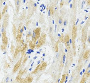 Anti-PHPT1 antibody
