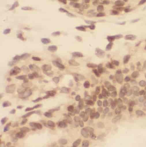 Anti-PI4KA antibody