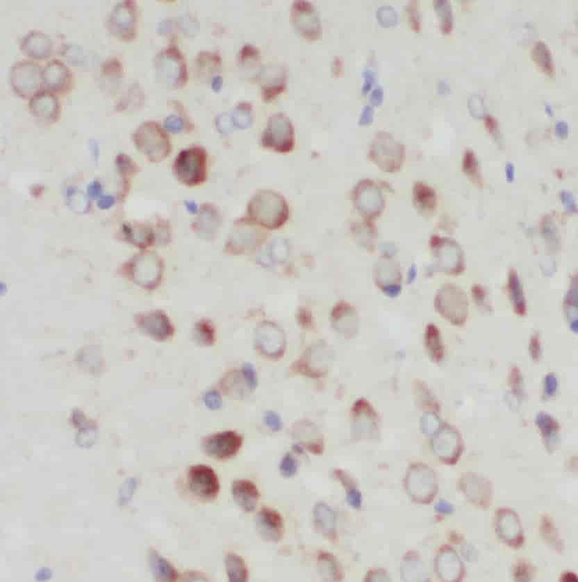 Anti-PIGT antibody