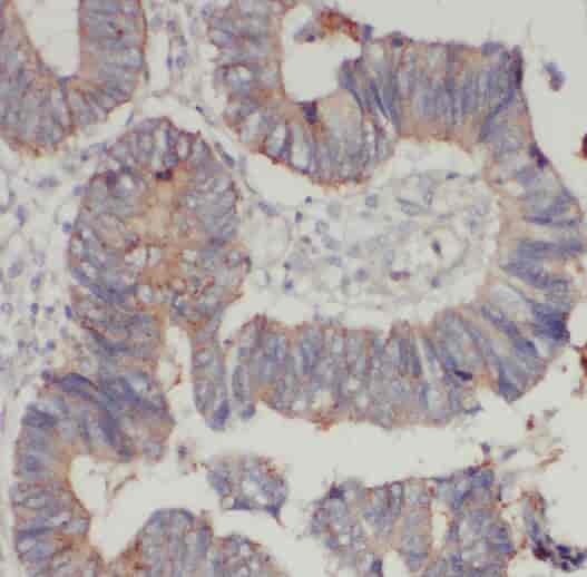 Anti-PKM2-specific antibody - Click Image to Close