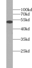 Anti-PLVAP antibody