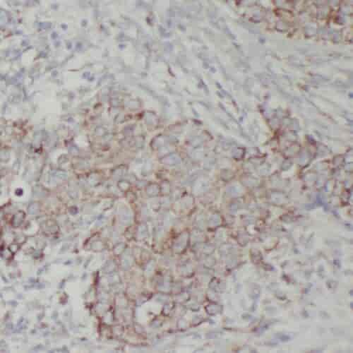 Anti-PPM1B antibody